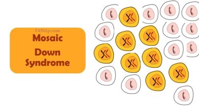 Mosaic Down Syndrome