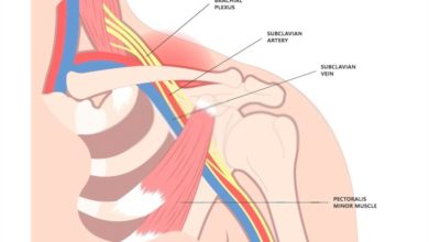 Thoracic Outlet Syndrome Exercises